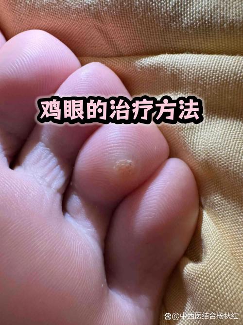 不起眼的小配件，其实最磨人