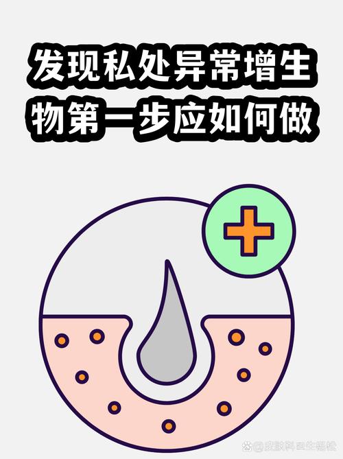 发现异常，你第一步该做什么