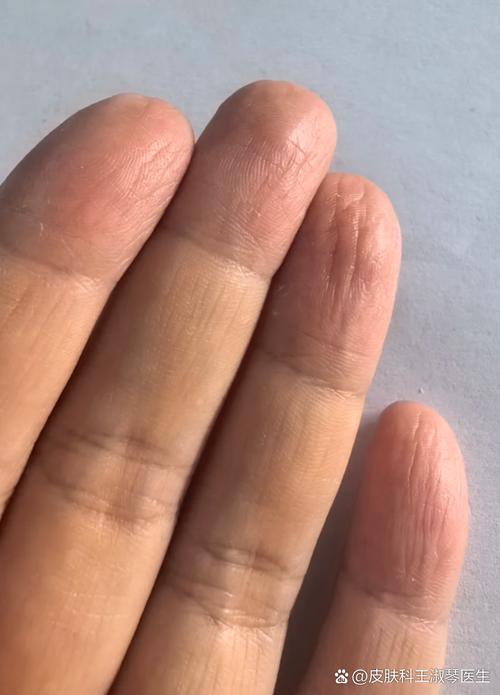 黄油软化至手指按压凹陷的状态图