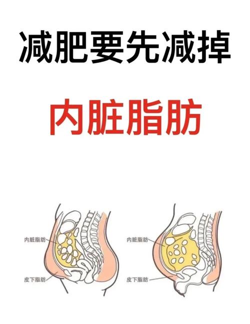 啤酒肚皮下脂肪与内脏脂肪对比解剖示意图