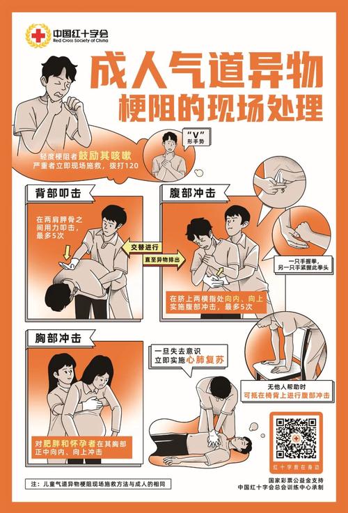 关于异物梗阻，你最搞不清的几个问题