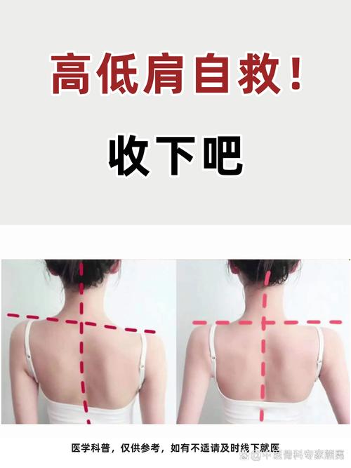 单侧背过重通勤包导致高低肩示意图