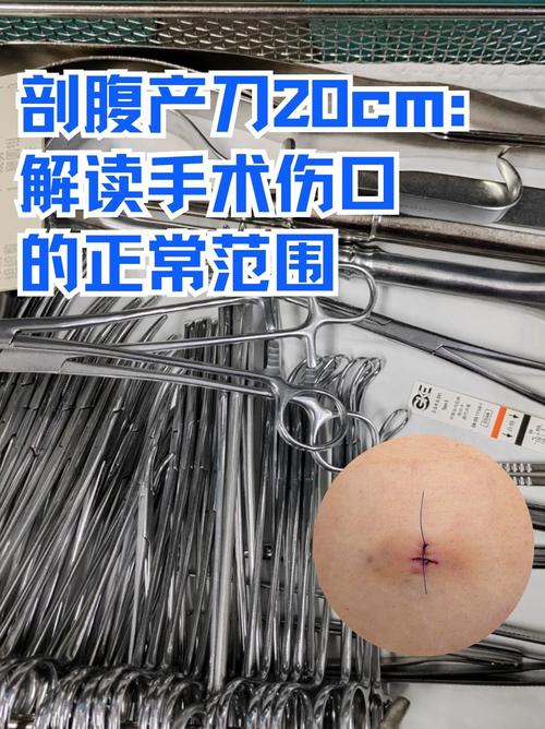 破局的几个小切口
