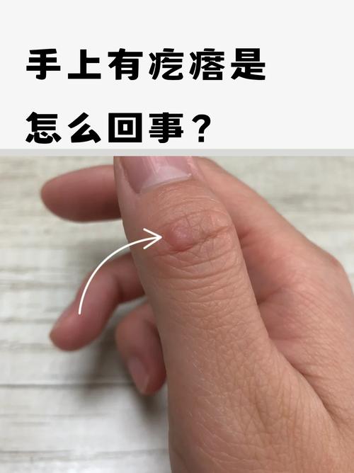 最后留个反常排除的后手