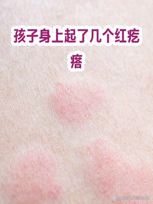 必须就医的宝宝打人危险红线