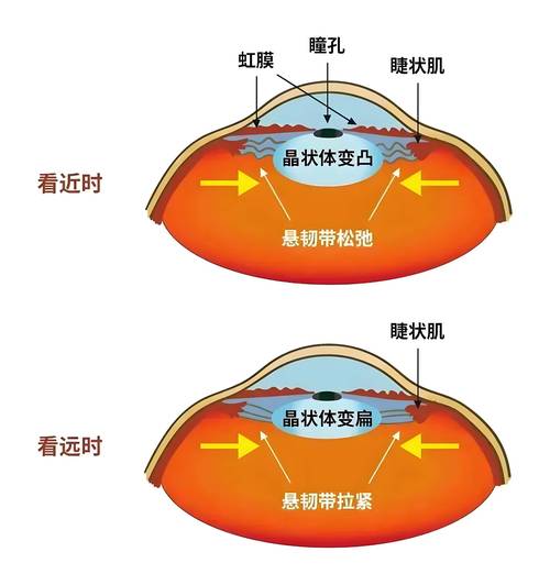 屏幕距离管控 眼睛看近处睫状肌收缩示意图