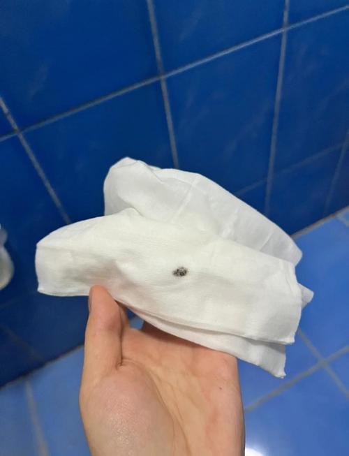 卫生间阴潮环境下长黑点的旧毛巾实拍