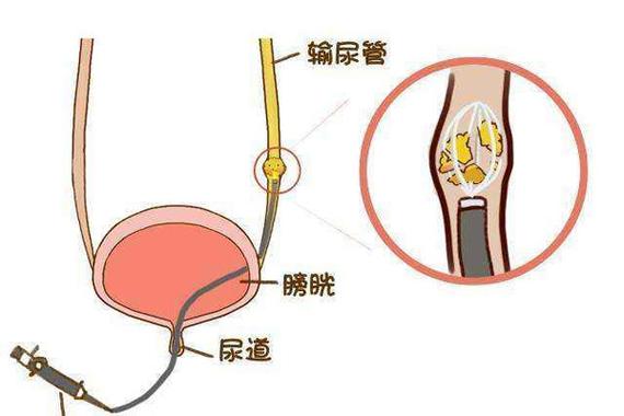 永远别忽略的附件——中涂管和侧视镜