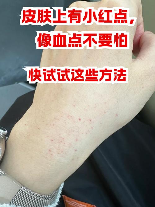 ⚡ 特别提醒：小白最容易碰到的血坑
