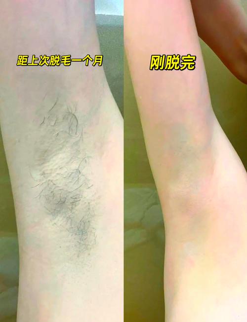 新娘蜜蜡脱毛疼痛表情示意图