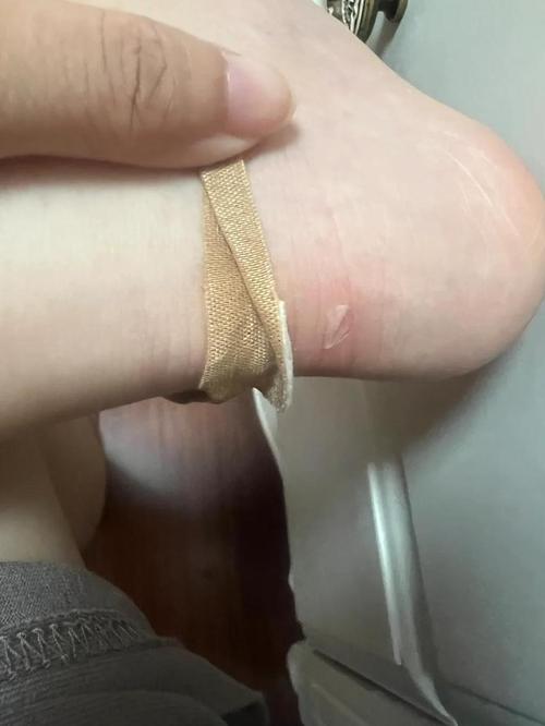 特种兵旅游磨破的脚跟创可贴 细节