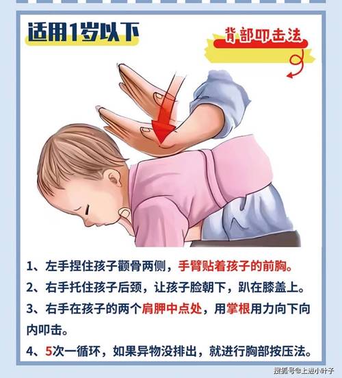 异物呛咳常见错误应对示范图