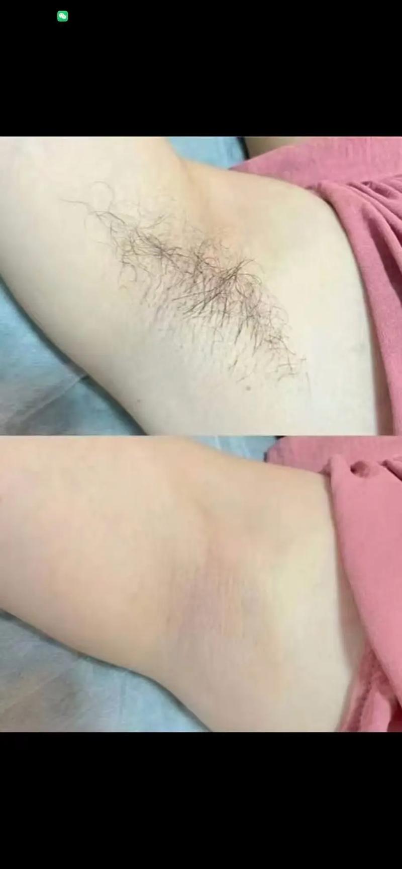 新娘用剃刀脱手臂毛发示意图