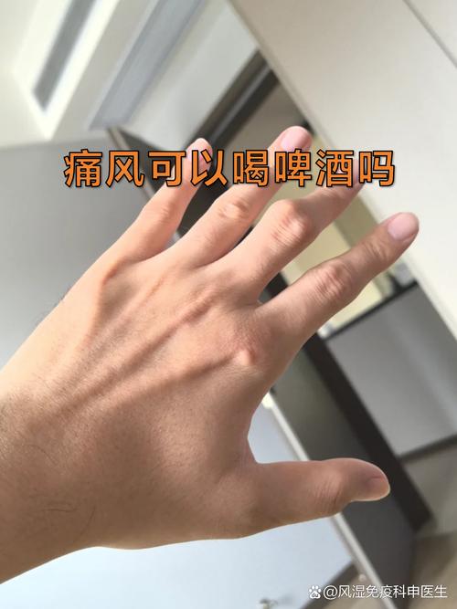 风险这东西,没人会掰开揉碎讲给你听