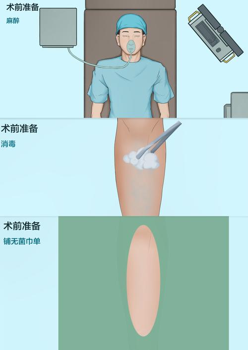 四、小步快跑：怎么给商业模式做一次“微创手术”