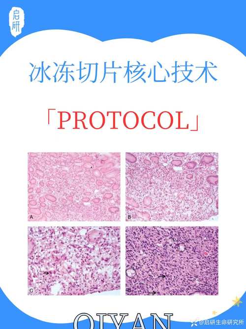 冷冻肉类反复解冻细胞结构破坏对比图