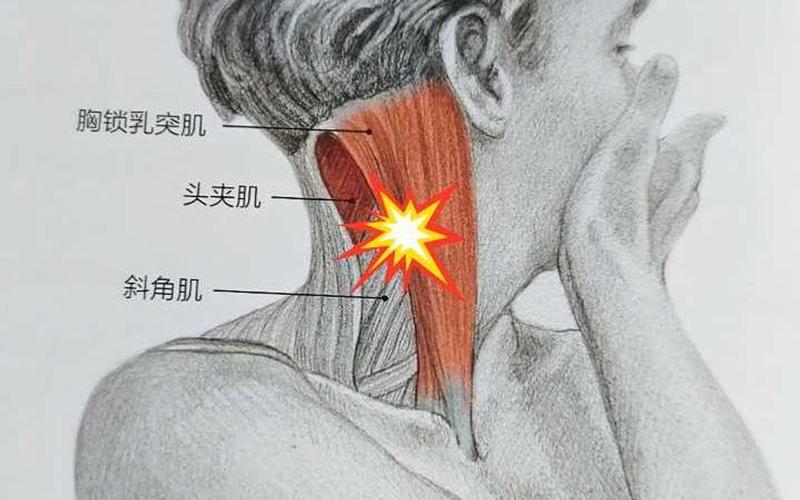 办公室久坐肩颈肌肉紧张示意图
