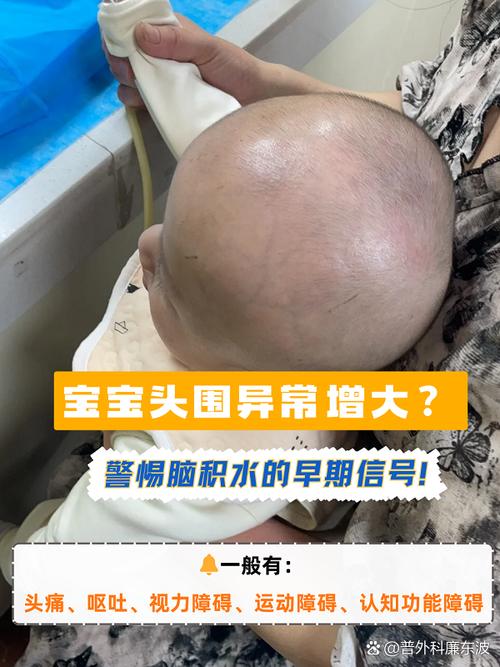 宝宝头围发育异常的就医红线，别硬扛也别瞎慌
