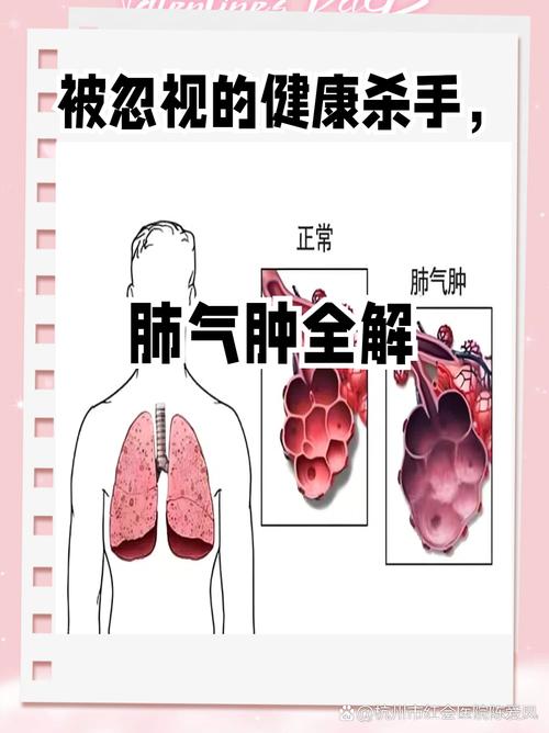 气源处理——被忽视的“肺”