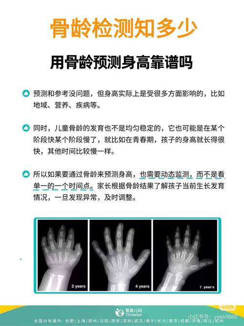 儿童骨龄检测报告单正常参考图