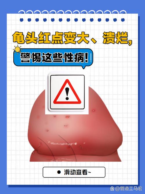 这些特殊情况，别自己瞎判断