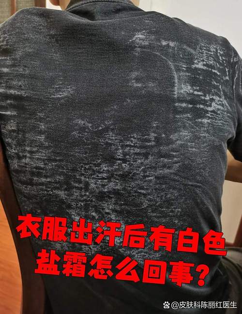 夏季出汗后衣服留下的白色盐渍图