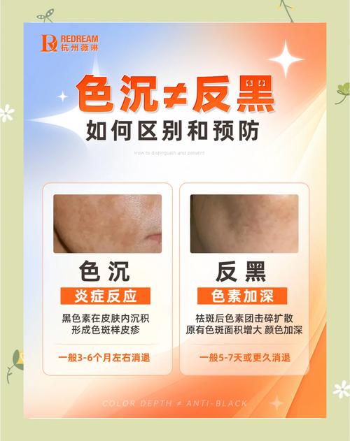 染色不均?先查前处理,再骂氧化