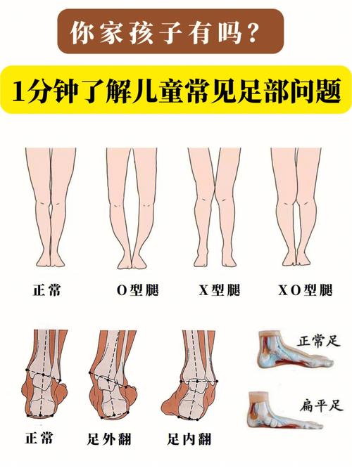 10月龄宝宝正常踮脚站立异常姿势对比图