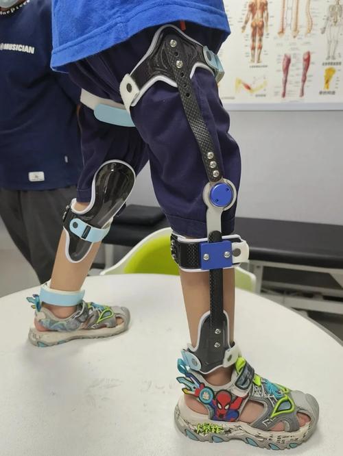 特殊需求儿童手工适配矫形辅具实拍