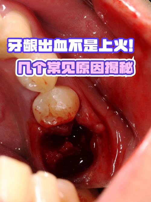 这些情况，必须咬咬牙上满血