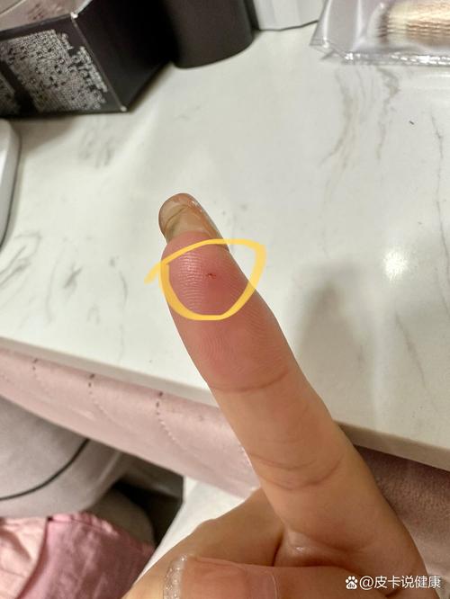 孩子书包掉出带牙印的半块橡皮