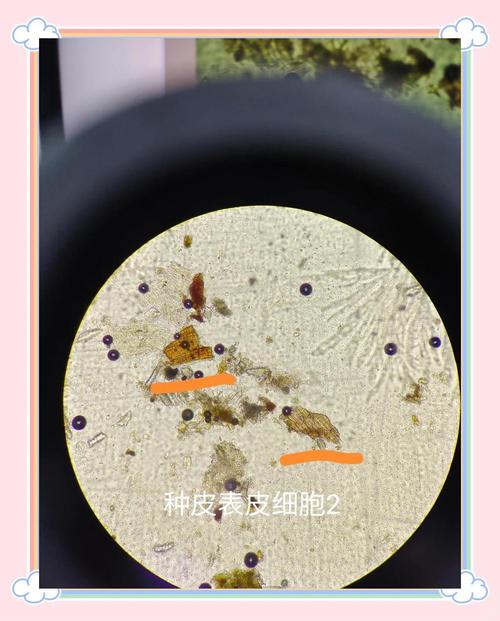 针片状超标的劣质机制砂显微镜图像