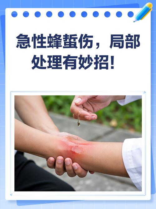户外被蜂蜇后紧急处理步骤漫画图
