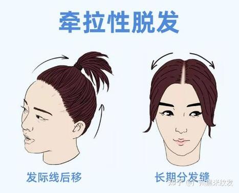 别等发缝宽到遮不住,才想起停掉这些习惯