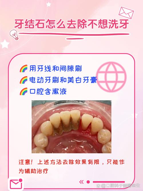 已经长了牙结石，该怎么办？