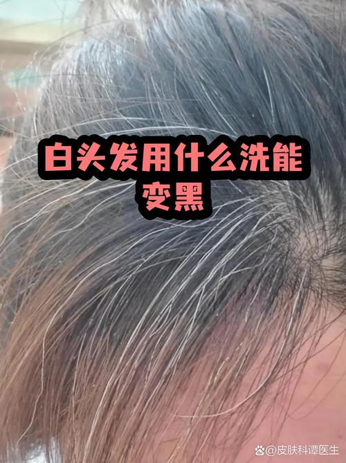 自己就能查，洗对了才有用