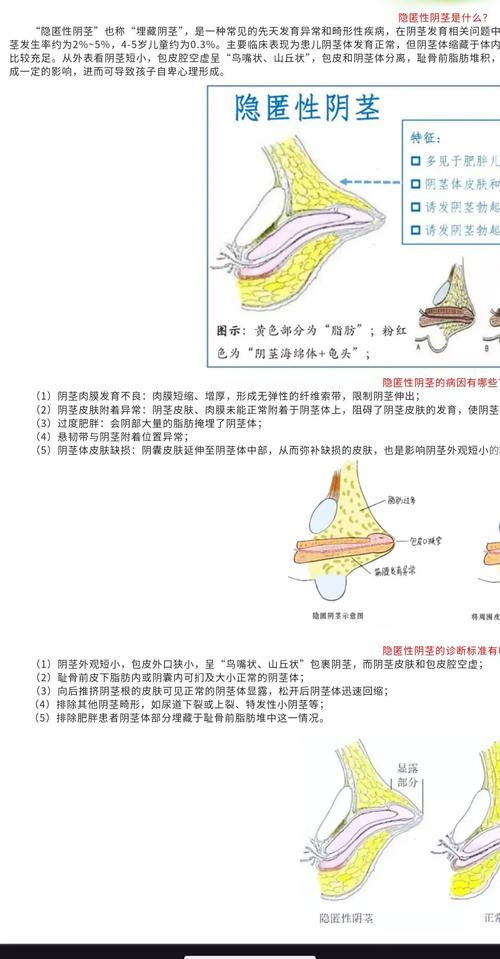 3. 找到那个最小的切入点,先动起来