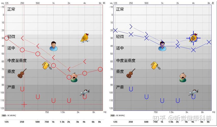 婴儿听觉频率敏感度曲线与常见玩具发声对比图