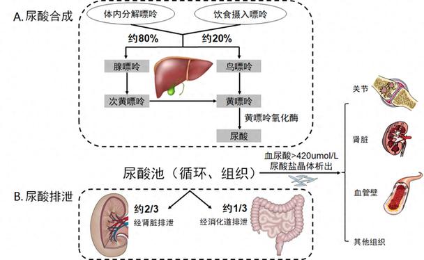 高尿酸患者嘌呤代谢流程示意图