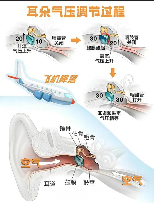 短途飞机起降咽鼓管调适动作示意图