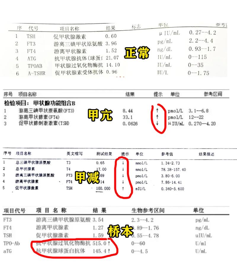 常见触发加费的体检异常项清单 甲状腺结节、血压临界、BMI超标