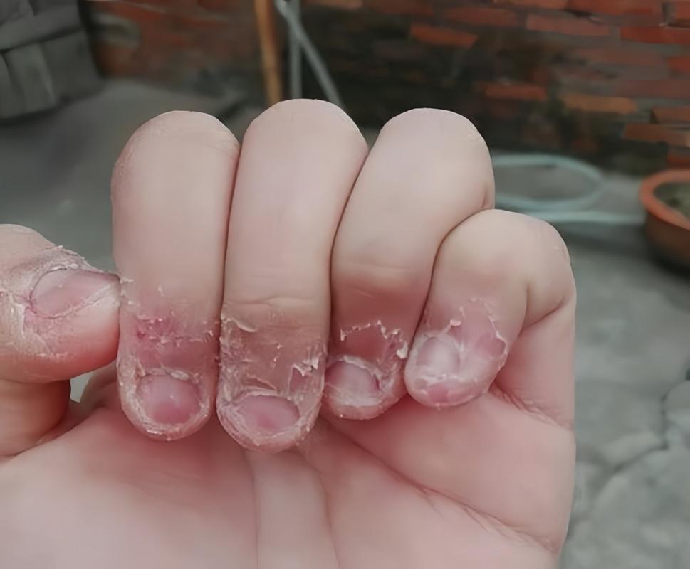 孩子考试压力大咬指甲特写