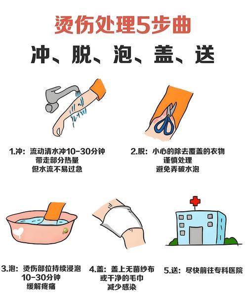 烫伤基础处置:这些常识别再记错了-仁者医