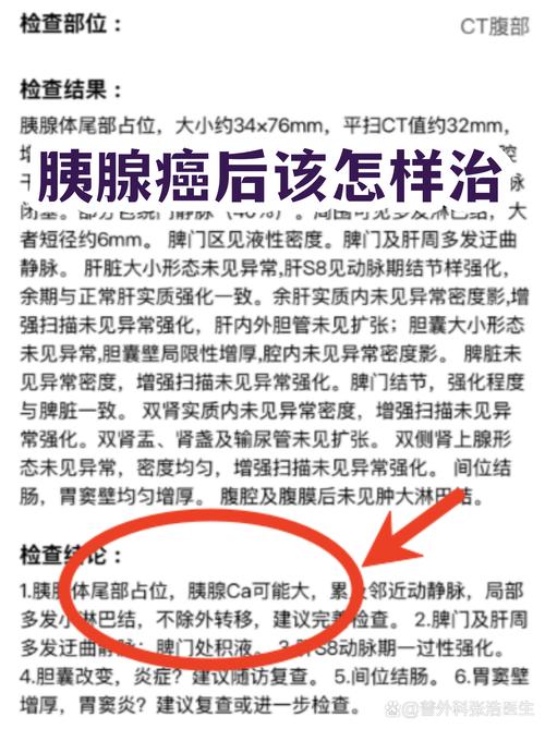 怎么治那种“明天一定写”的癌