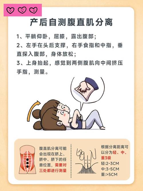 居家产后腹直肌分离自测步骤示意图