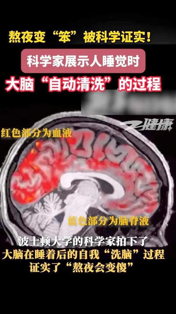 大脑的夜间排练:荒诞剧情里藏着什么?