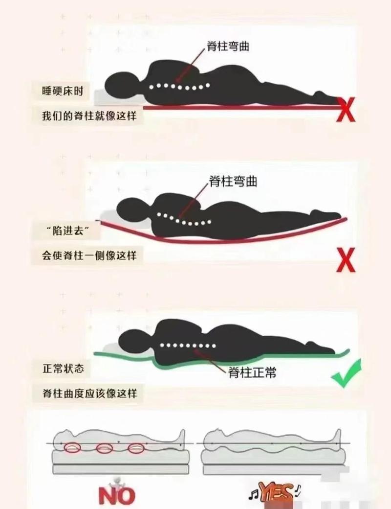 床上侧卧起身脊柱受力示意图