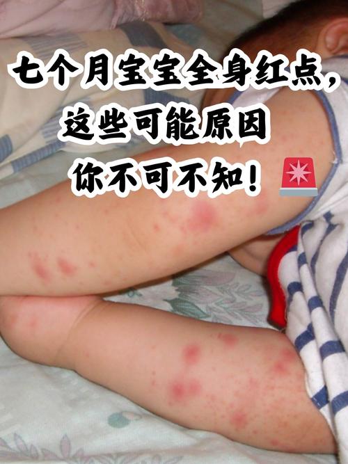 幼儿入园接触过敏红斑示意图