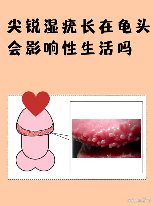 QA:你们最常问的几个尖锐问题