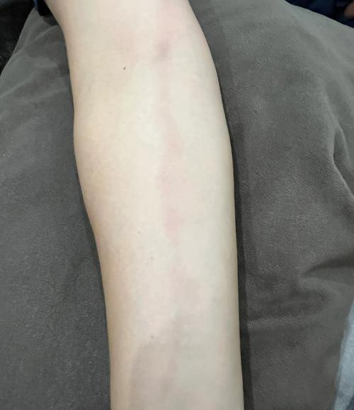 不能拖的怕黑就医红线